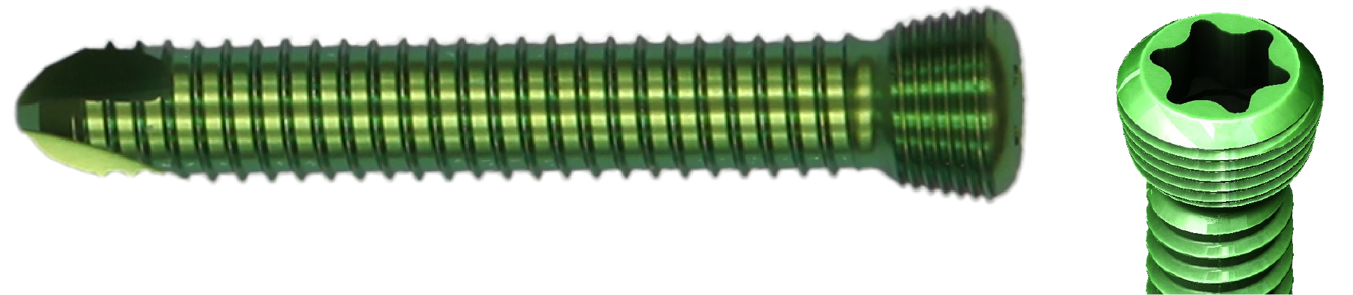 Locking Screws